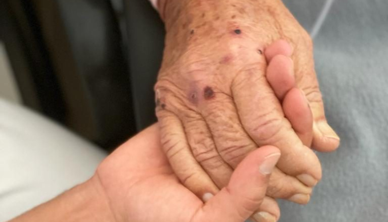 El programa de cuidados paliativos a domicilio de Atención Primaria de Tenerife ha atendido a más de 200 pacientes