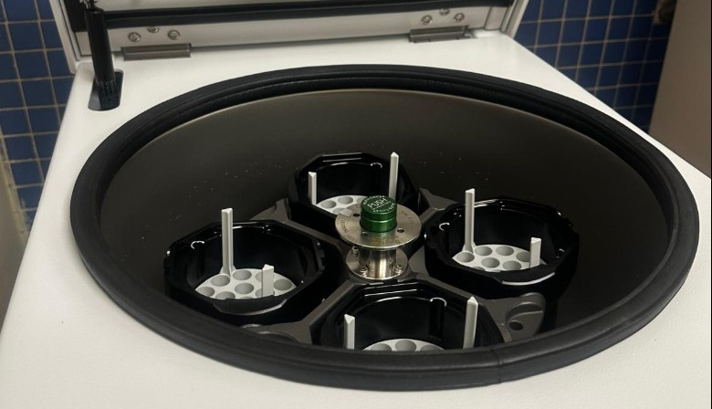 La Gerencia Sanitaria de La Gomera instala instala centrífugas de muestras de sangre en las zonas básicas de salud