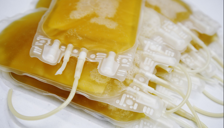 El SCS recuerda la importancia de donar plasma, un componente sanguíneo esencial