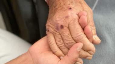 El programa de cuidados paliativos a domicilio de Atención Primaria de Tenerife ha atendido a más de 200 pacientes