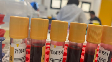 Sanidad comienza a administrar la terapia génica para la Hemofilia B