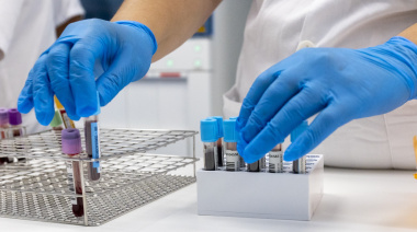 Sanidad notifica en Tenerife un brote de sarampión con cuatro casos confirmados