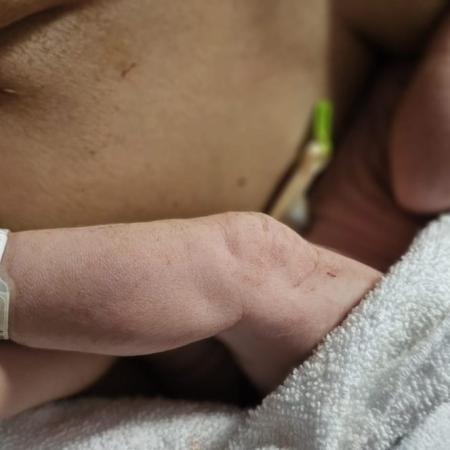 El Hospital La Candelaria registra casi 3.000 bebés en el primer año de implantación del sistema de identificación